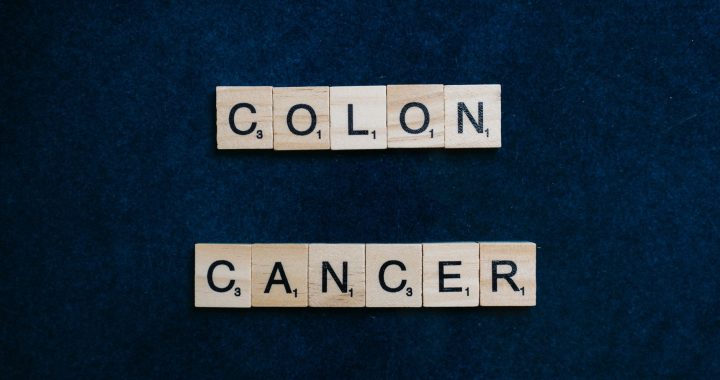 AI model for cancer detection